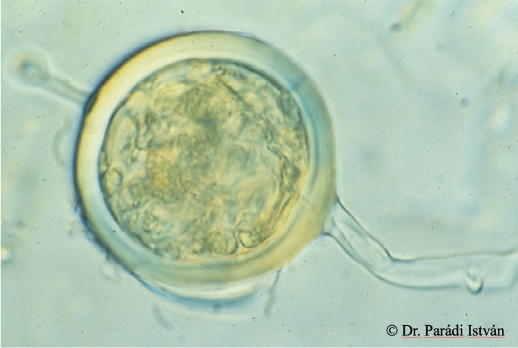 mikorrhizagomba-spóra